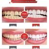 Douyin Whitening & Fresh Breath Oral Probiotics Toothpaste: Removes Yellow, Brightens White, Cleans & Refreshes for Men & Women.