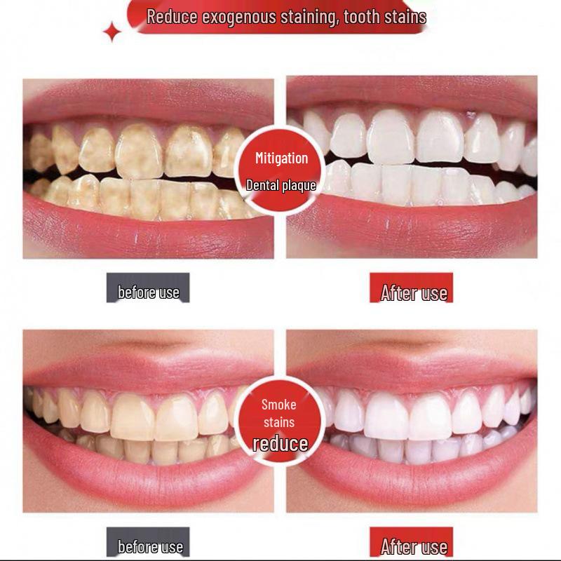 Douyin Whitening & Fresh Breath Oral Probiotics Toothpaste: Removes Yellow, Brightens White, Cleans & Refreshes for Men & Women.