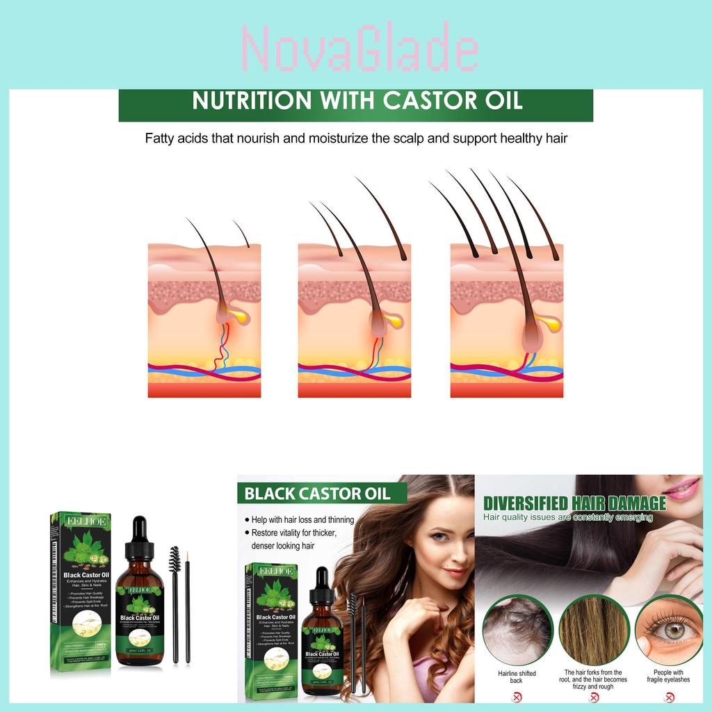 Eelhoe Castor Oil Hair Growth Serum Rich Nourishing Scalp Massage Treatment 60ml Set