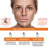 Lighten Facial Freckles Dark Spots Brightening Moisturizing Skin Lotion