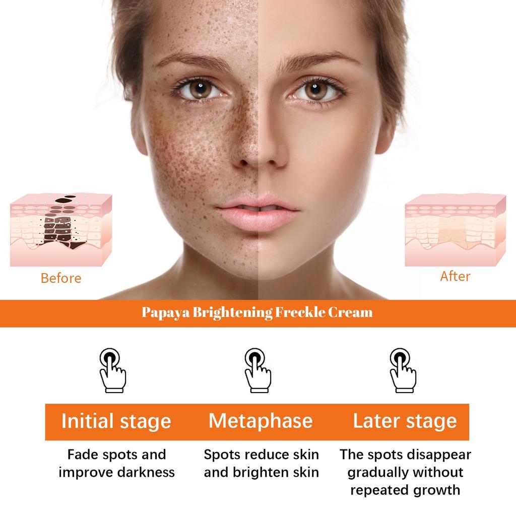 Lighten Facial Freckles Dark Spots Brightening Moisturizing Skin Lotion