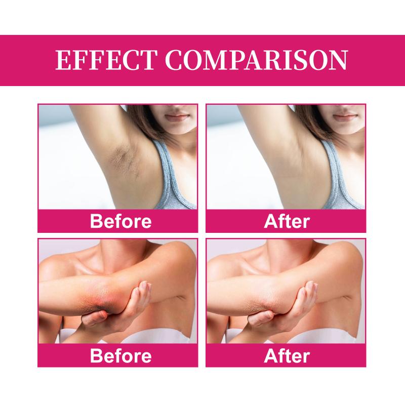 Revitalizing Whitening Cream for Underarms Elbows Knees Joints and Intimate Areas
