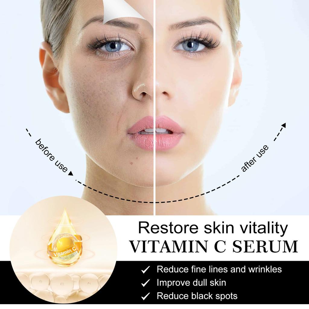 Hoygi Vitamin C Serum For Deep Hydration Brightening And Firming Skin Care 30ml