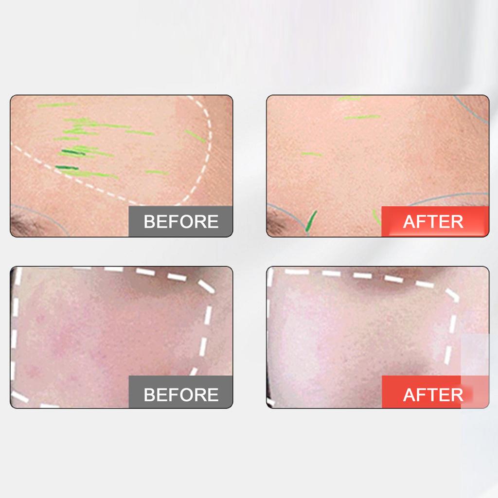 7 Color Light Face Cover LED Facial Light Rejuvenation Tightening Skin Care Device for Home