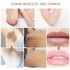 Whitening Cream For Dark Skin Underarm Bleaching Armpit Lightening And Intimate Area Woman Moisturizer Korean Skin Care Products