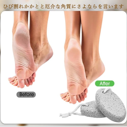 Set of 2 Natural Pumice Stones for Foot Care, Exfoliating, Foot Massage, Improves Blood Circulation, Washable, Reusable, Unisex, Smooth Heels, Skin Ca