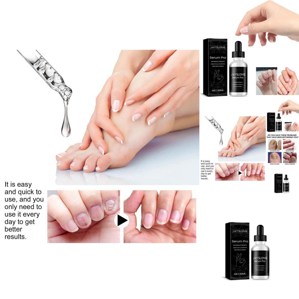 Nourishing Jaysuing Nail Repair Essence For Healthy Strong Nails 30ml