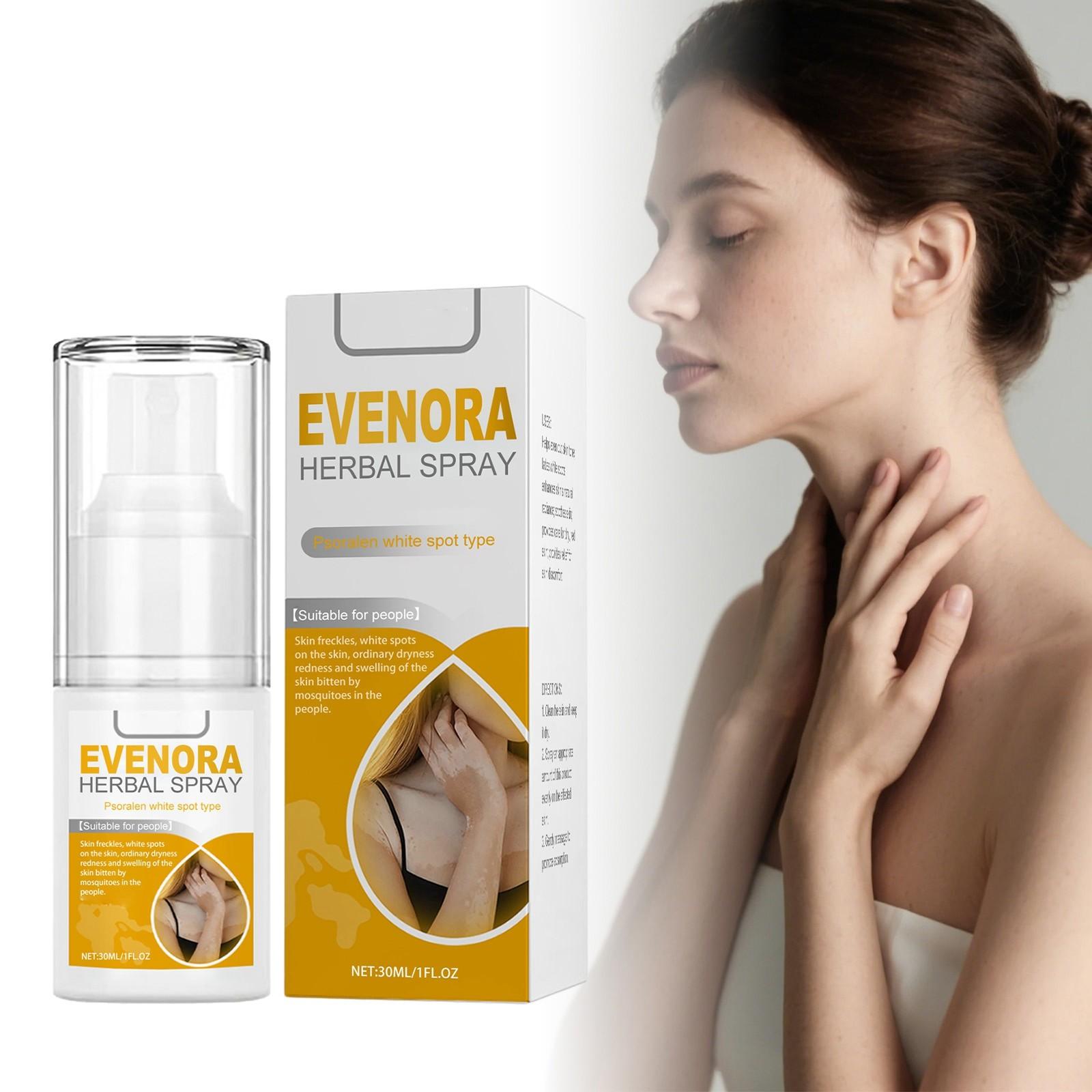 Herbal Spray Skin Care Spray Soothes Discomfort, Improves Redness And Brightens The Skin,30ml One Size