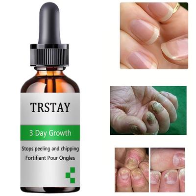 7DAYS Repair Nail Fungus Treatments Essence Foot Care Serum Toe Nails Fungal Removal Gel Anti-Infection
