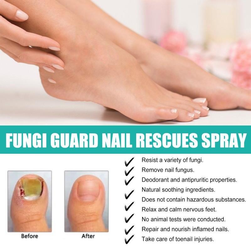 Spray de Soin des Ongles Ximonth Pour des Ongles Plus Forts et Élimination des Odeurs 30ml Solution Efficace