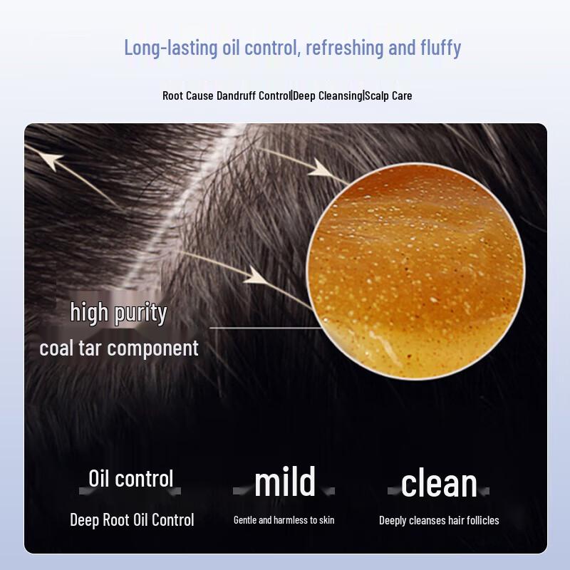 sakose Anti-Dandruff & Oil Control Hair Treatment