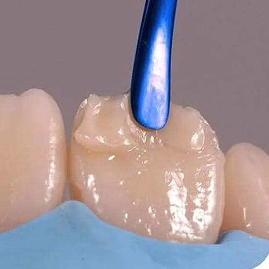 GDC Titanium Coated Composite Anterior Placing (Tncipcm)