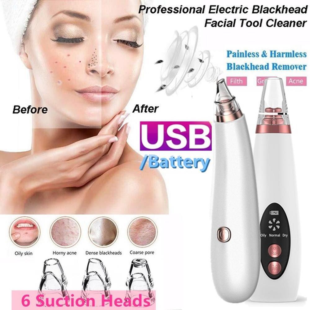 Buy Deep Clean Electric Blackhead Remover Vacuum Acne Cleaner Pore Remover Skin Facial Cleanser