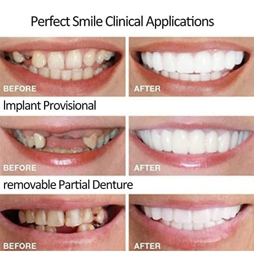 Dentures, False Teeth, Smile Now with Comfortable, Matching Upper and Lower Dentures In Bright White Tones! Restore Your Smile In Minutes At Home!
