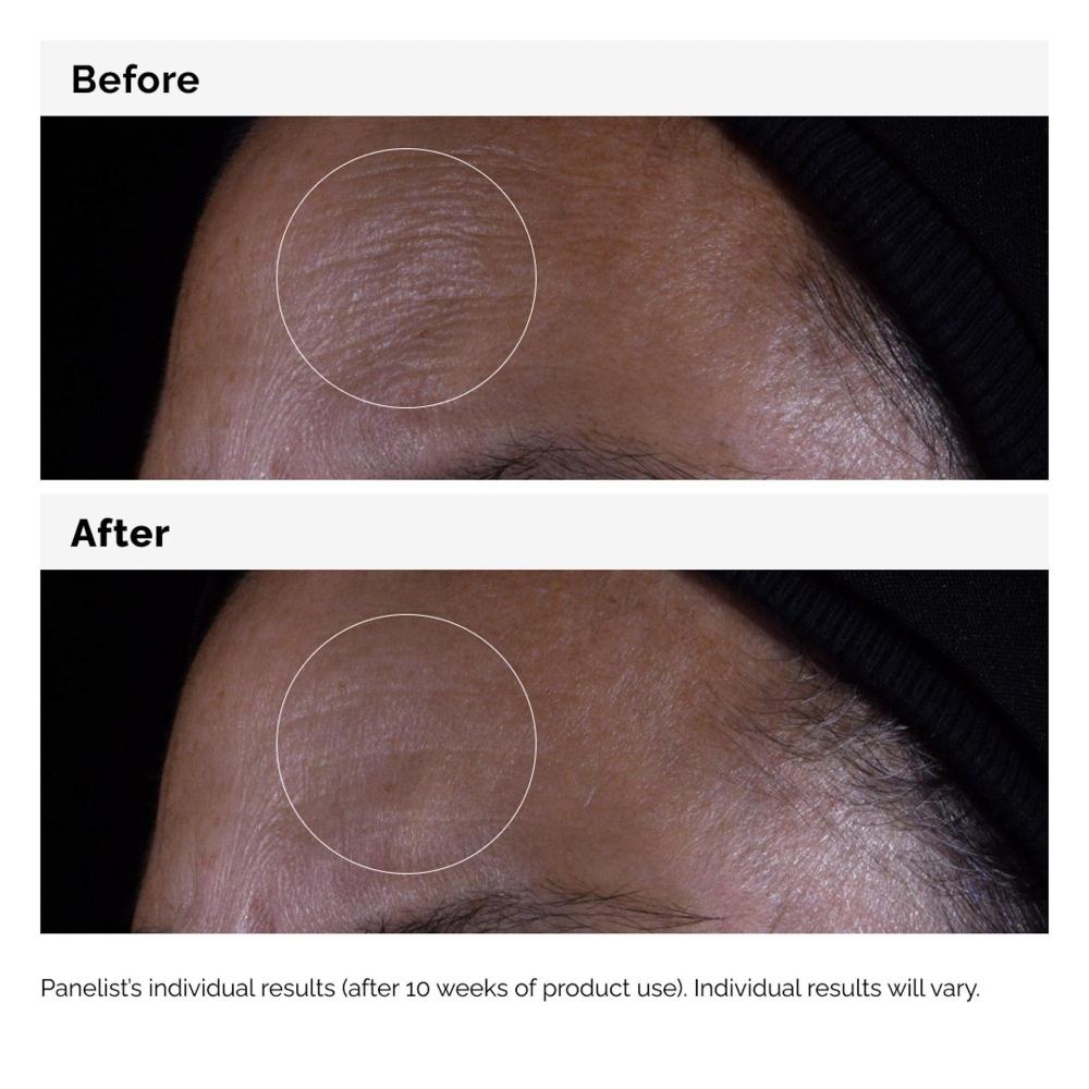 The Ordinary Gf 15  Serum For Visible Skin Repair And Wrinkles 1.0 Oz