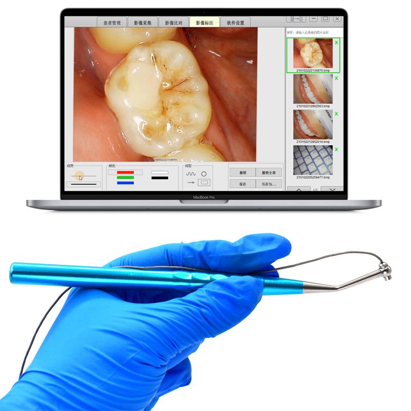 Dental Orthodontics Leagues LED Visual Dental Digital Micro Intra Oral Camera Wifi Foot Control HD Visual Camera for Endo Motor