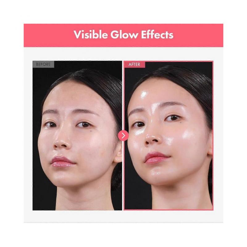 Arbutin 7% Tranexámsav 4% Krém 50ml Világosító K-Beauty