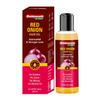 Red Onion Hair Oil 200ml | Natural Hair Nourishment For Stronger, Shinier, Smoother Hair | Reduces Hair Fall & Promotes Growth