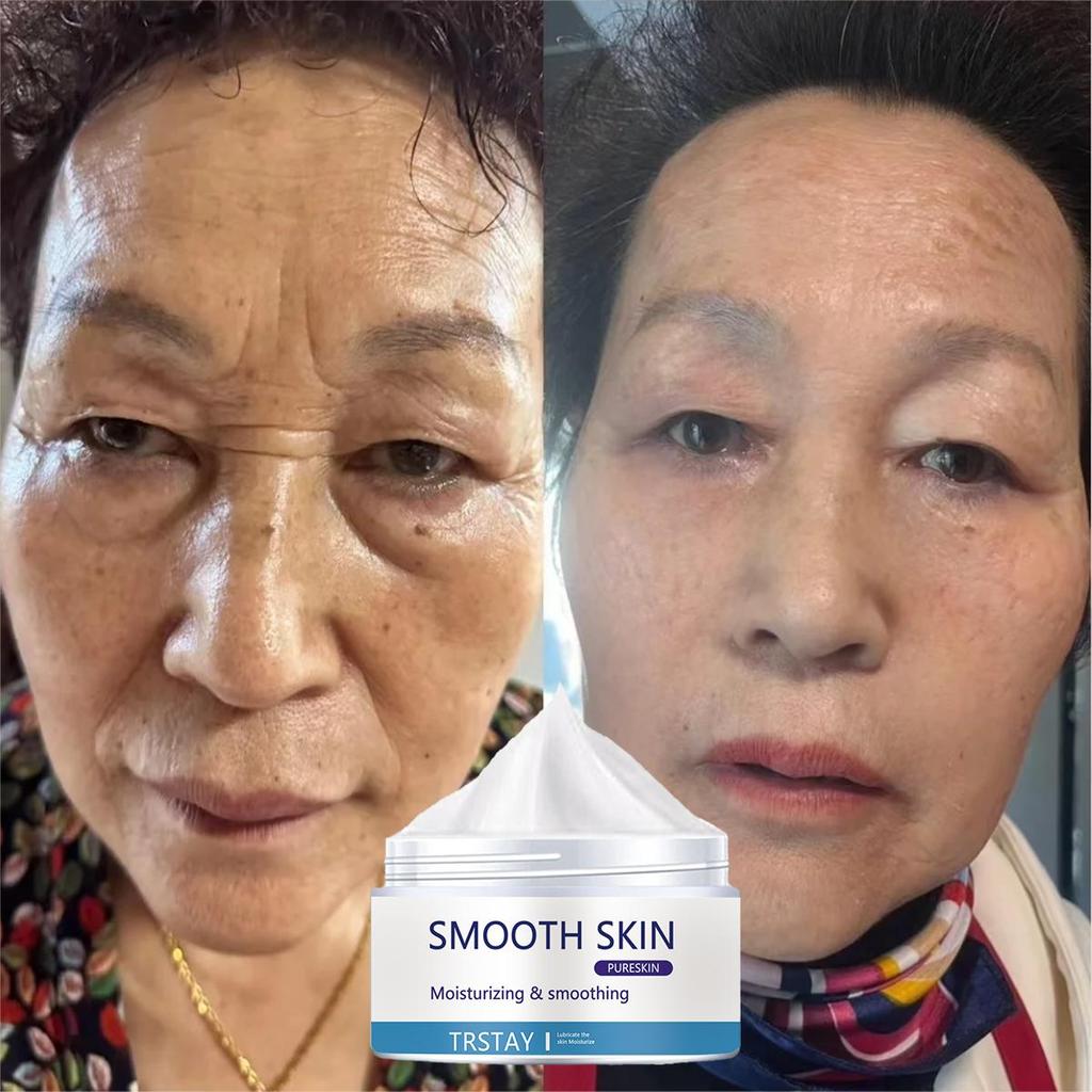 Whitening and Acne Removing essence Cream, brightening facial skin, anti-oxidation and anti-aging, moisturizing cream