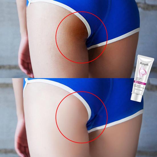 RtopR Mango Buttock Enhancement Cream Smooth Firming Hip Curve Shaping Skin Care