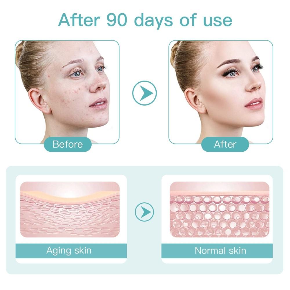 Mini HIFU Radiofrequenz Multifunktions-Schönheitsinstrument Gesichtsstraffung und Festigung Anti-Aging RF EMS Maschine