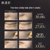 Lin Qing Xuan Red Camellia Revitalizing Oil Essence