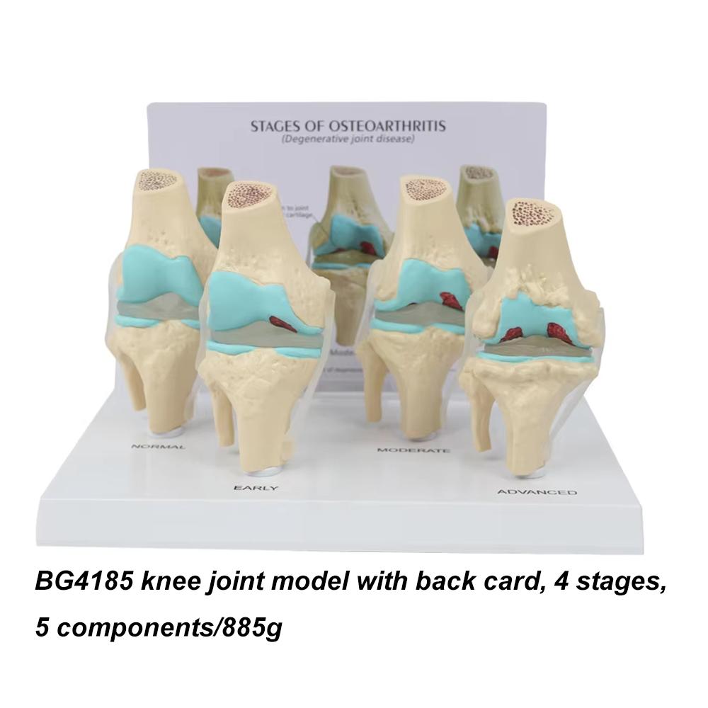 Medical teaching tools Skeleton PVC model Student teaching equipment Knee joint model Skin Model Vertebral model