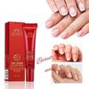 Skin Treatment Nail Foot Repair Cream Nail Fungus Dead Herb Supplies