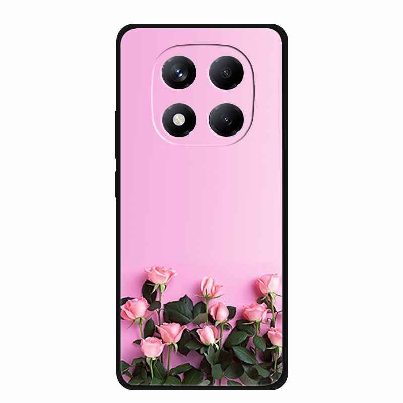 For Redmi Note 15 Case China Version 6.77" Camera Lens Protector Silicone Soft Cover Funda for Redmi Note 15 5G Coque New Note15