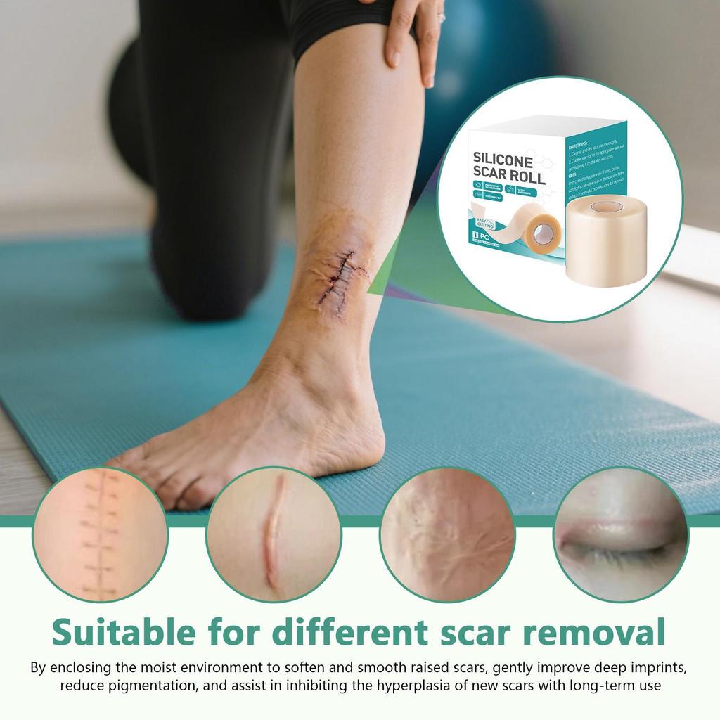 Silicone Scar Sheets 4x150cm Hydrocolloid Bandages Roll Self Adhesive Wound Dressing for Burns Blisters Skin Care Recovery