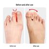 Double Hole Silicone Big Toe Separator Orthotic Corrector