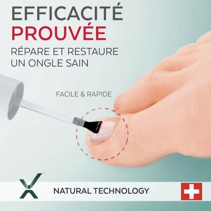 Fragile Nails Serum - PODERM - Silicon - 100% Natural - Vegan - 8ml Bottle