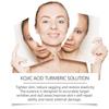 30Ml Kojic Acid Freckle Removing Whitening  Fade Pigmentation Melasma Dark Spots  Repair Serum
