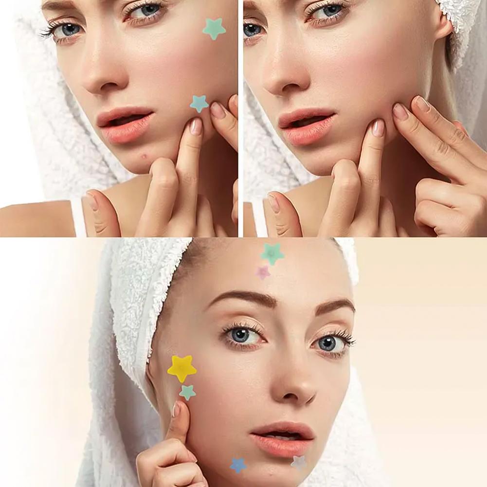 200Pcs Acne Patches Fade Blemishes Pimple Marks Closed Acne Blemishes Hydrocolloid Star Heart Shaped Cover Acne Pimple Patch