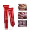 Skin Treatment Nail Foot Repair Cream Nail Fungus Dead Herb Supplies