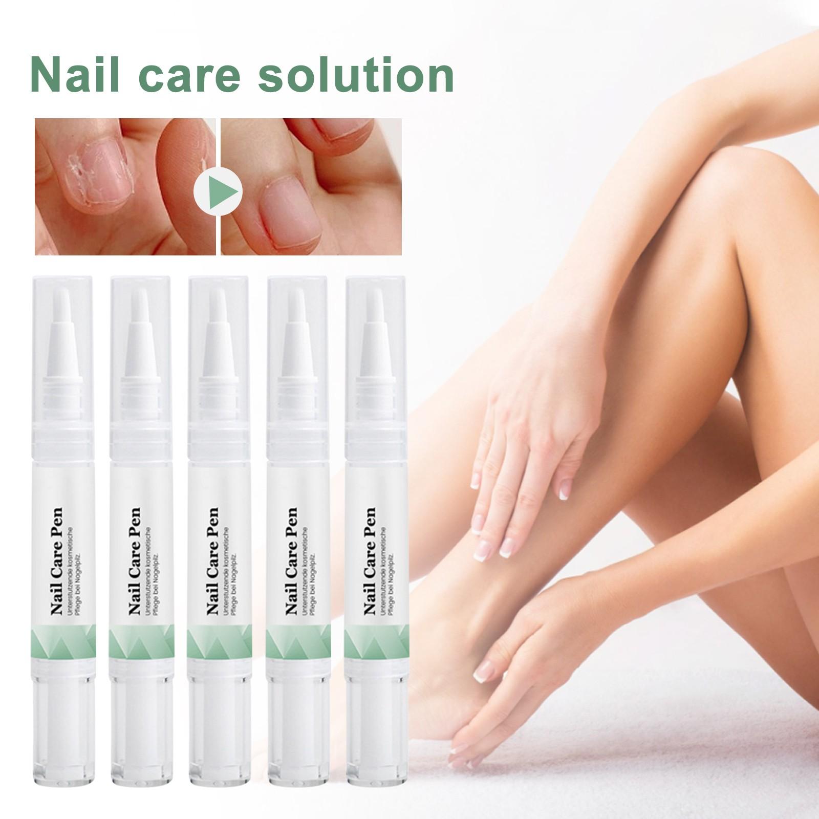 

Ручка для ухода за ногтями, масло для кутикулы ногтей, ручка для поврежденных ногтей, переключатель для укрепления ногтей, алоэ вера и масло чайного дерева для восстановления повреждений, 3 мл One Size