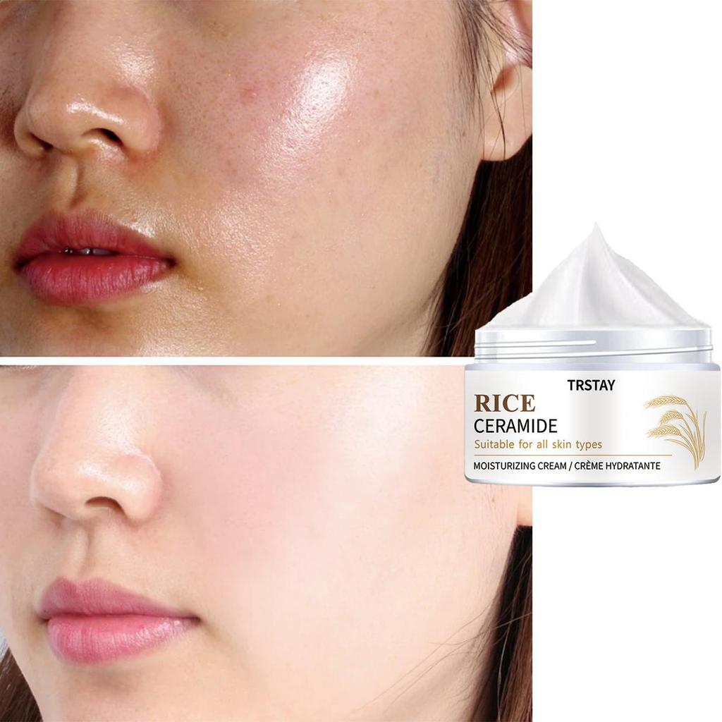 Moisturizing Cream Improves Uneven Skin Tone On the Face Provides Moisturizing and Nourishing Hydration To Nourish the Skin