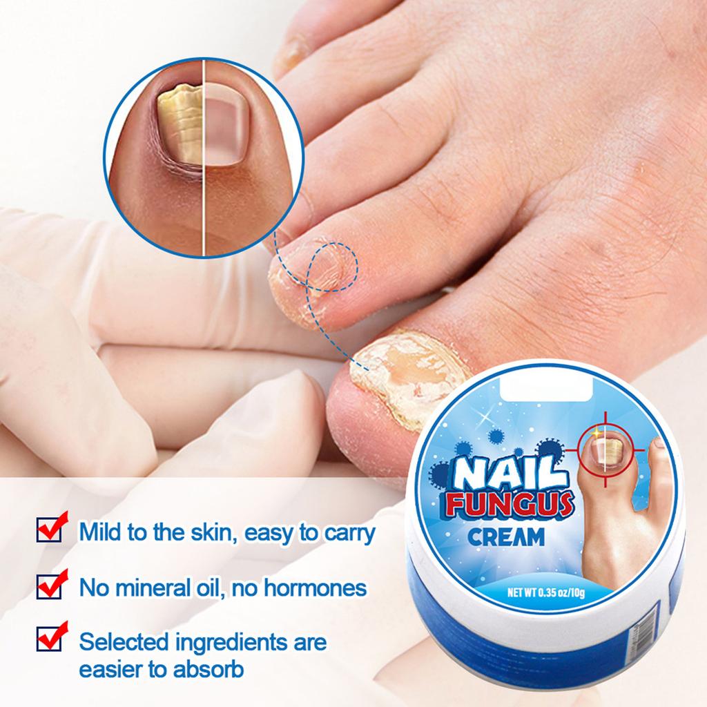 Gips Ny Bright Nail Plaster Lindrer Onychomycosis Og Neglepleie