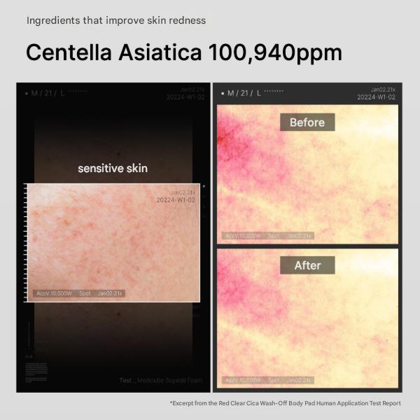 Medicube Red Clear Cica Wash-Off Body Pad 50 Pads (200ml) (3 Options)