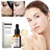 Limited time!!Ouhoe Facial Serum - Nourishes And Protects Facial Skin, Enhances Skin Elasticity And Smoothness, Hydrating Skincare Essence