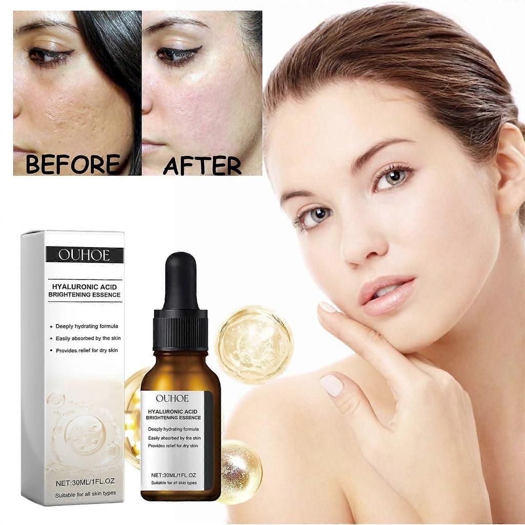 Limited time!!Ouhoe Facial Serum - Nourishes And Protects Facial Skin, Enhances Skin Elasticity And Smoothness, Hydrating Skincare Essence