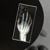 Autumu X Ray Hand Bones Phone Case Cover for Samsung Galaxy S26 S25 Edge S24 S23 Ultra S22 Plus S21 FE S20 + Art Customized Fund