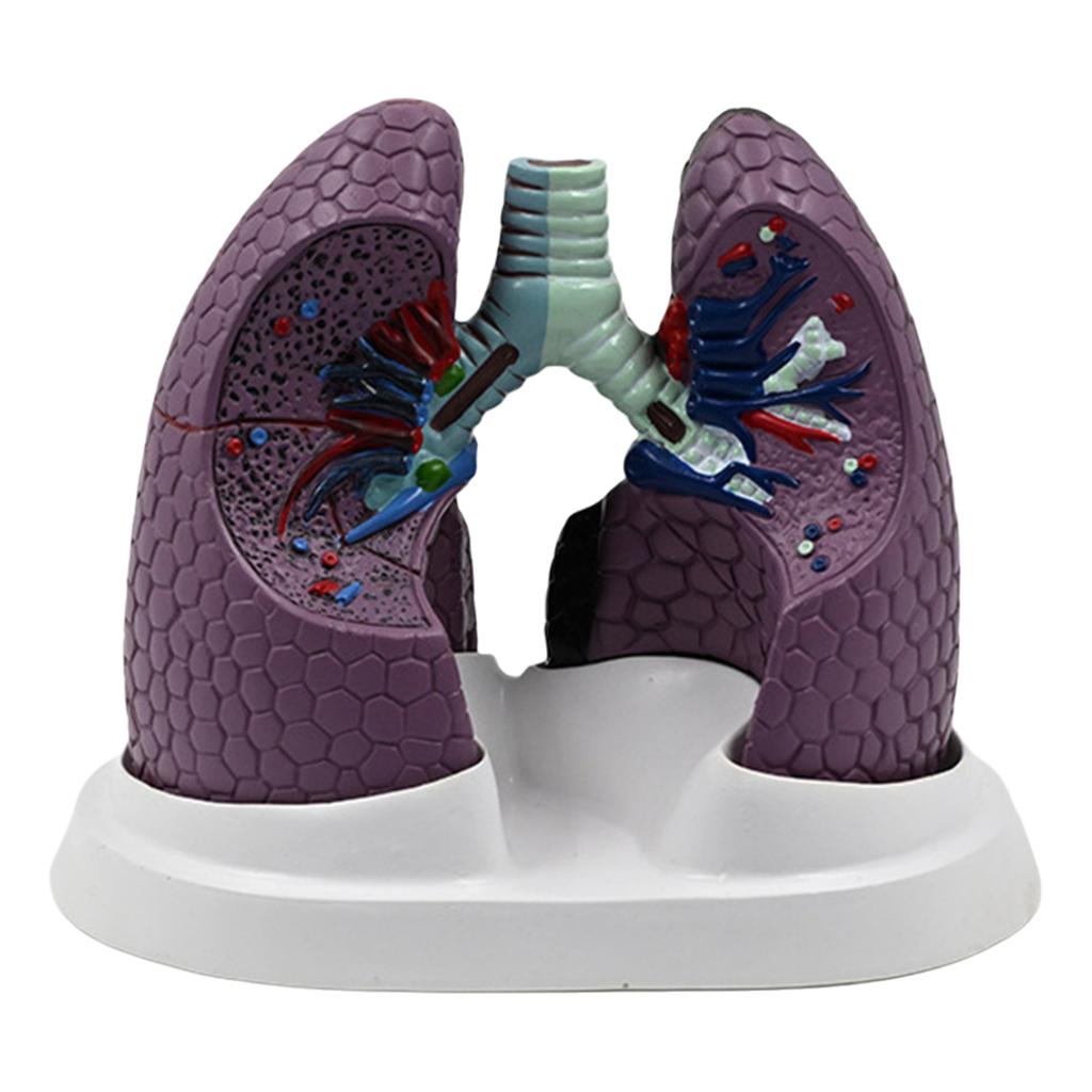 Anatomical Pathological Lung Model Human Lung Anatomy Model Normal and Pathological Lung Anatomy Model for Teaching Tool