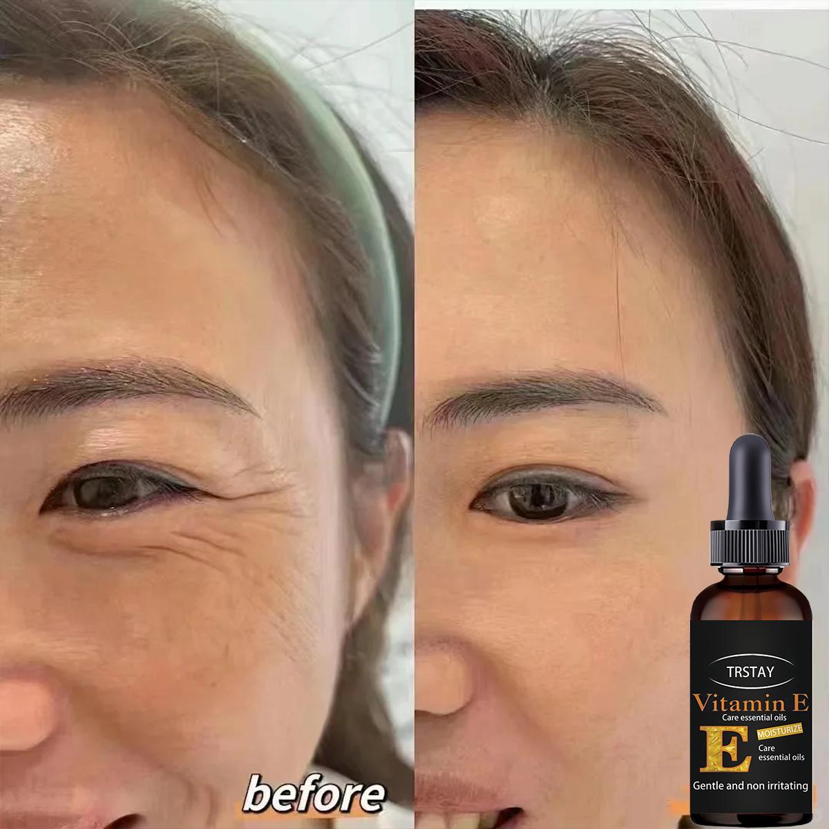 

Ретинол против старения, сыворотка для удаления морщин, лифтинг, осветление кожи лица, выцветание тонких линий вокруг глаз, увлажняющая, укрепляющая эссенция для лица 5ml