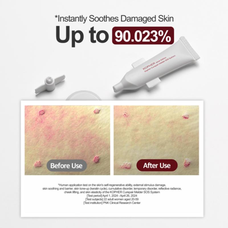 [Kopher] Curepair Melder SOS System 1.5ml (20ea)