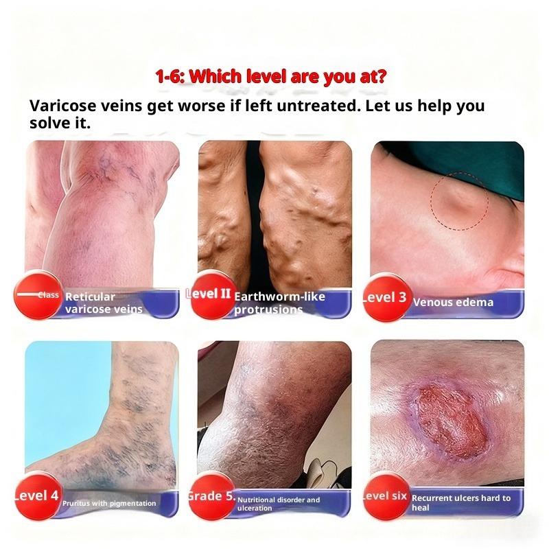 Soothing Cream for Varicose Veins, Red Blood