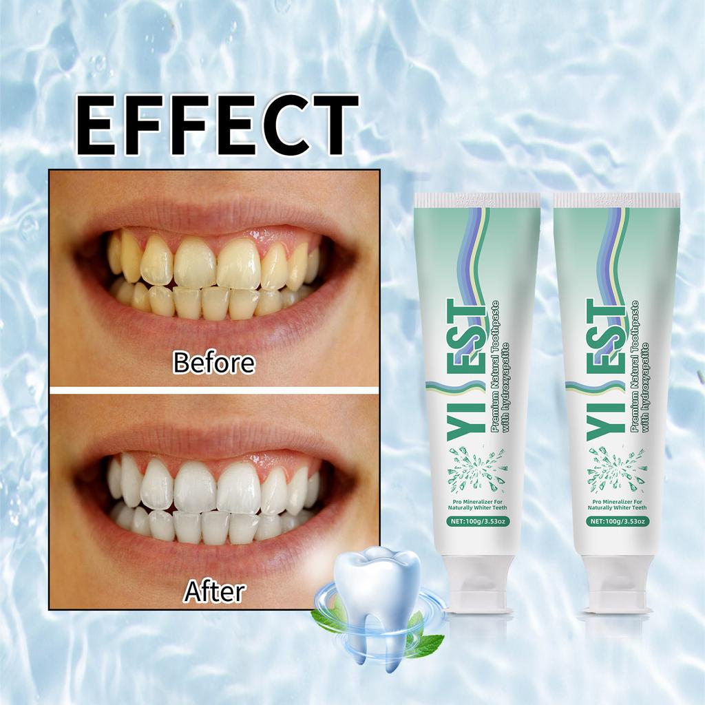 Pasta de dientes de nano-hidroxiapatita sabor menta para el mal aliento, pasta de dientes blanqueadora para manchas blancas, aliento fresco