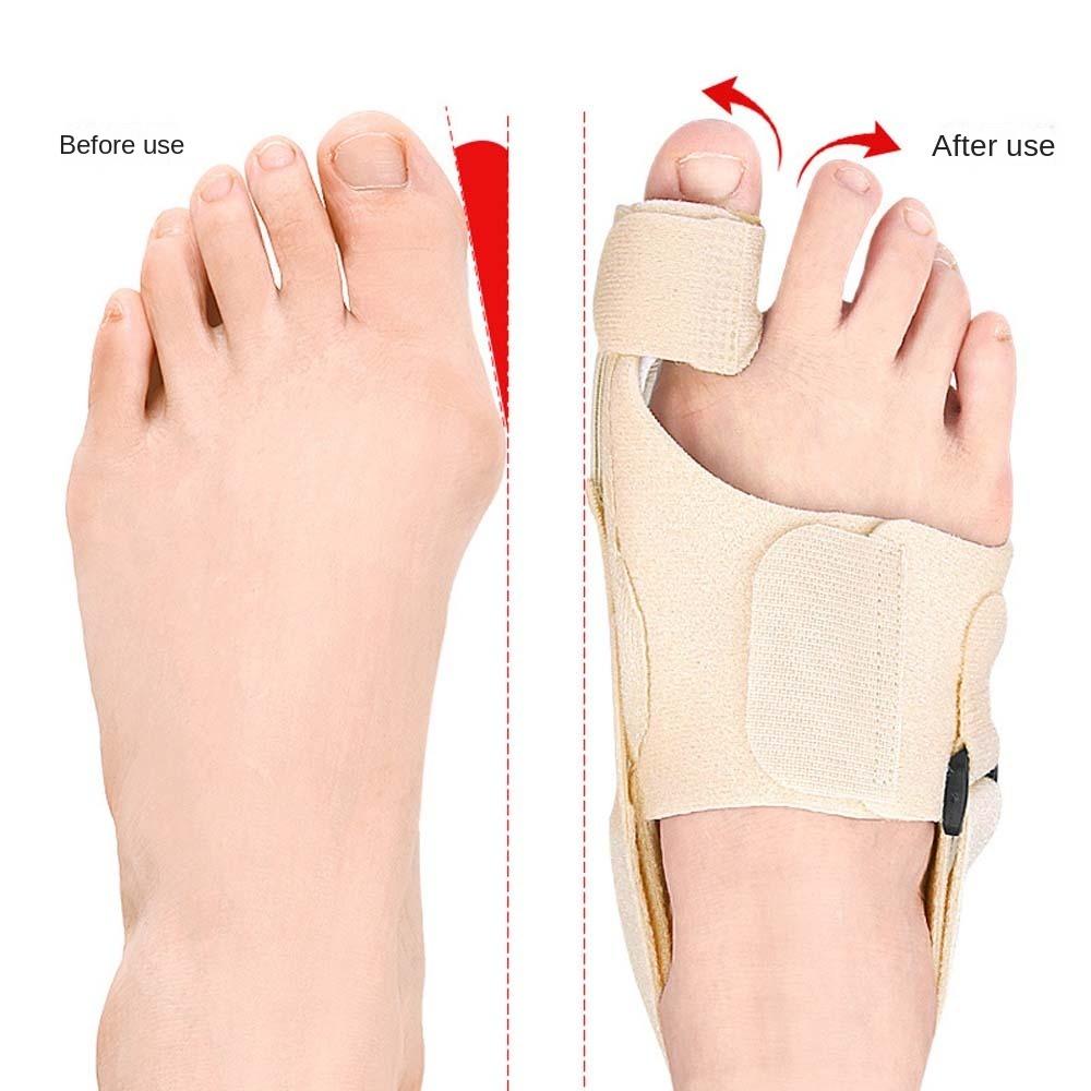 Bunion Protector Toe Straighteners Thumb Valgus Adjuster Toe Separators Toe Orthotics Brace  Unisex