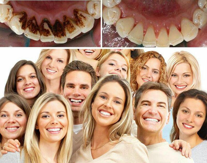 Elektryczny ultradźwiękowy skaler dentystyczny do czyszczenia zębów kamienia nazębnego osadu Zestaw z 5 sztukami końcówek czyszczących