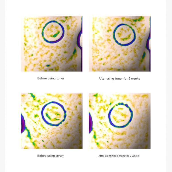 Medicube Toner cu Colagen Triplu 4.0 (Reînnoit)140ml (3 Opțiuni)